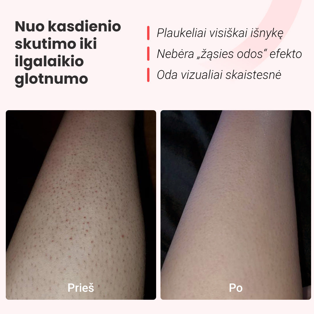 IPL fotoepiliatorius