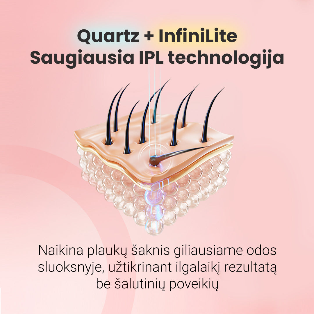 IPL fotoepiliatorius